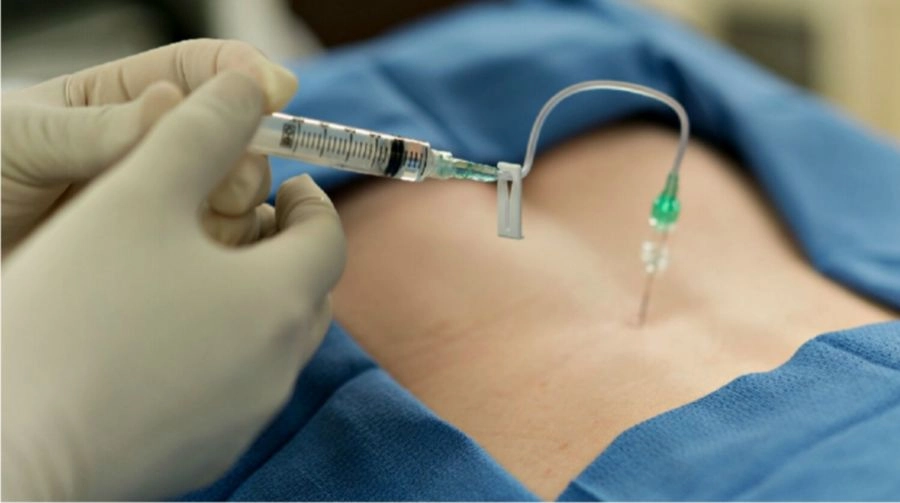 epidural-kit-3