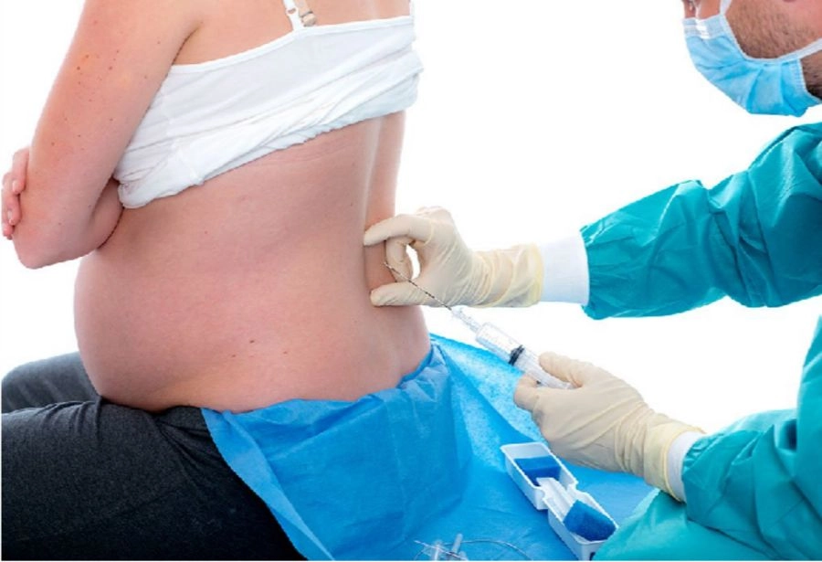epidural-kit-2